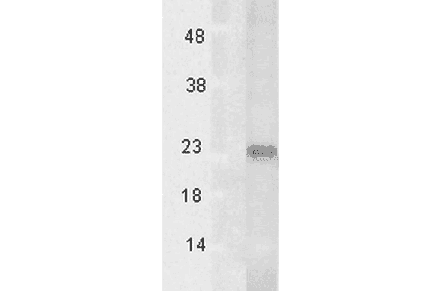 Western Blot - Anti-TSP23 Antibody [Tsp232A] (A304805) - Antibodies.com