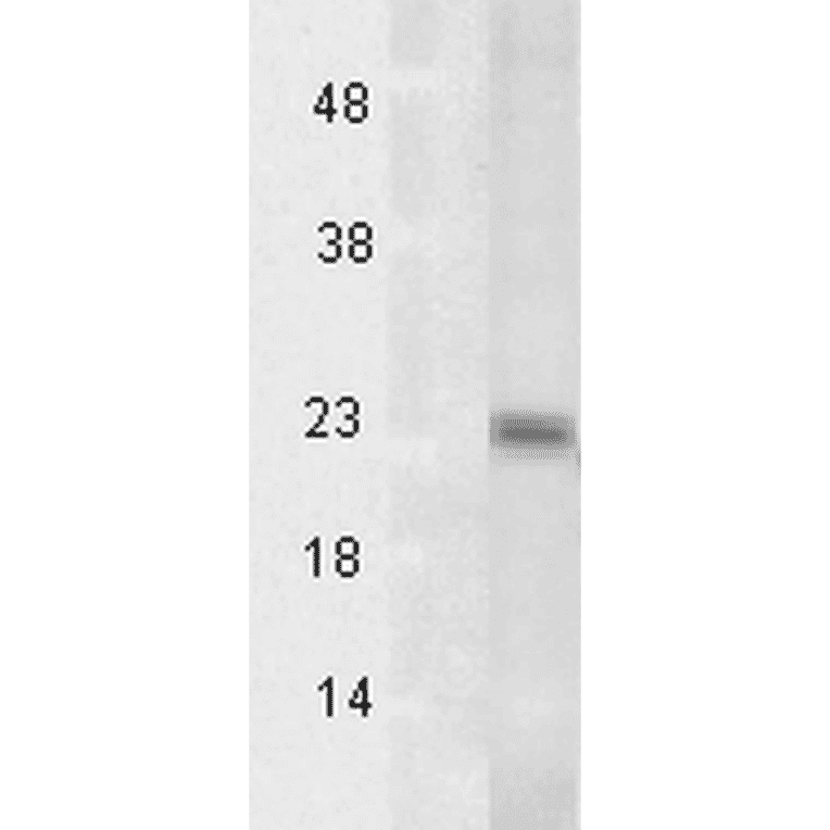Western Blot - Anti-TSP23 Antibody [Tsp232A] (A304805) - Antibodies.com