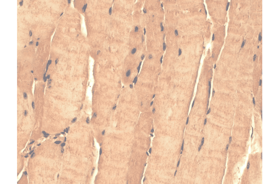 Immunohistochemistry - Anti-TSP23 Antibody [Tsp232A] (A304805) - Antibodies.com