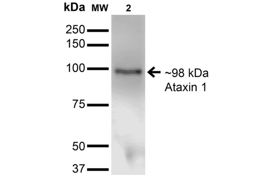 Western Blot - Anti-Ataxin 1 Antibody [S65-37] (A304806) - Antibodies.com