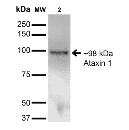Western Blot - Anti-Ataxin 1 Antibody [S65-37] (A304806) - Antibodies.com