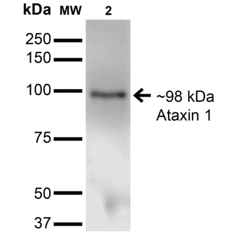 Western Blot - Anti-Ataxin 1 Antibody [S65-37] (A304806) - Antibodies.com