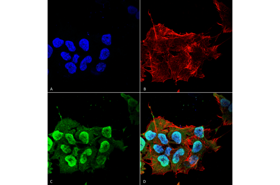 Immunocytochemistry/Immunofluorescence - Anti-Ataxin 1 Antibody [S65-37] (A304806) - Antibodies.com