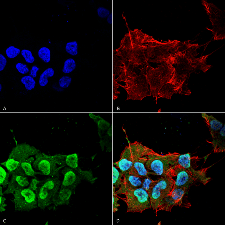 Immunocytochemistry/Immunofluorescence - Anti-Ataxin 1 Antibody [S65-37] (A304806) - Antibodies.com