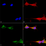 Immunocytochemistry/Immunofluorescence - Anti-Ataxin 1 Antibody [S65-37] (A304806) - Antibodies.com