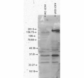 Western Blot - Anti-Phosphotyrosine Antibody [G104] (A304807) - Antibodies.com