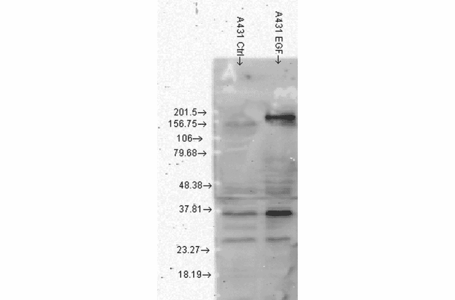 Western Blot - Anti-Phosphotyrosine Antibody [G104] (A304807) - Antibodies.com