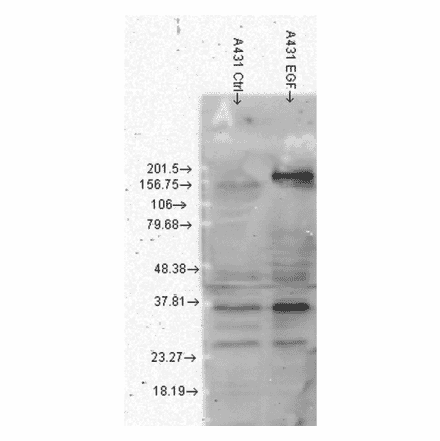 Western Blot - Anti-Phosphotyrosine Antibody [G104] (A304807) - Antibodies.com