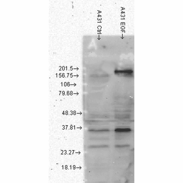 Western Blot - Anti-Phosphotyrosine Antibody [G104] (A304807) - Antibodies.com