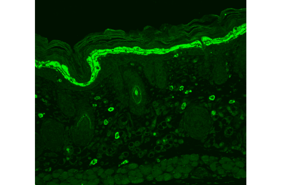 Immunohistochemistry - Anti-Phosphotyrosine Antibody [G104] (A304807) - Antibodies.com