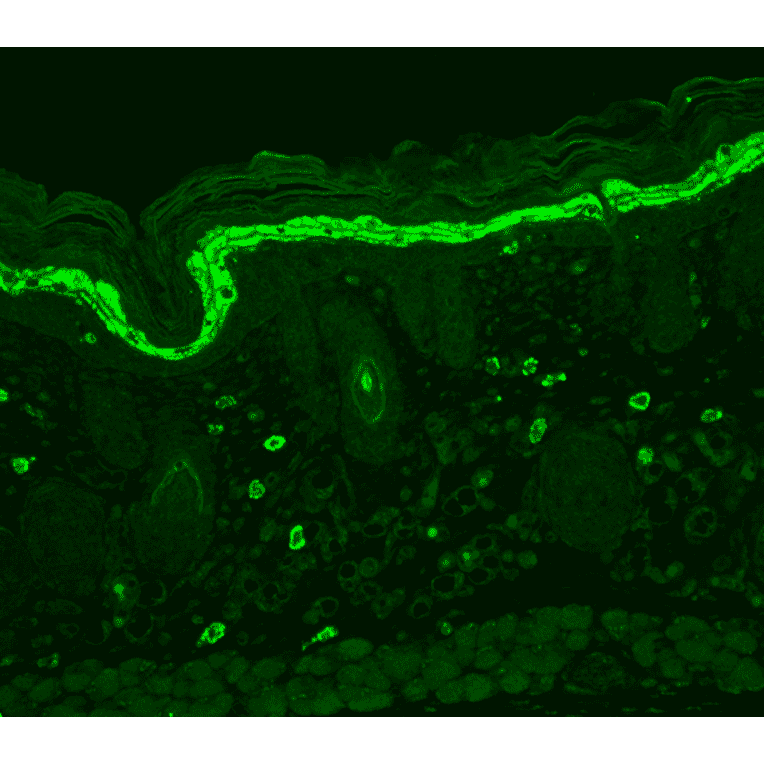 Immunohistochemistry - Anti-Phosphotyrosine Antibody [G104] (A304807) - Antibodies.com