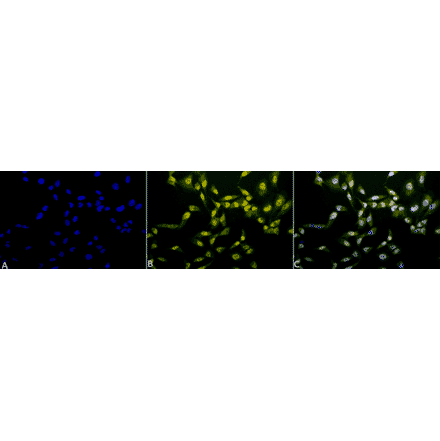 Immunocytochemistry/Immunofluorescence - Anti-Phosphothreonine Antibody (A304810) - Antibodies.com