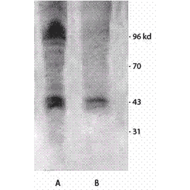 Western Blot - Anti-Phosphothreonine Antibody (A304810) - Antibodies.com