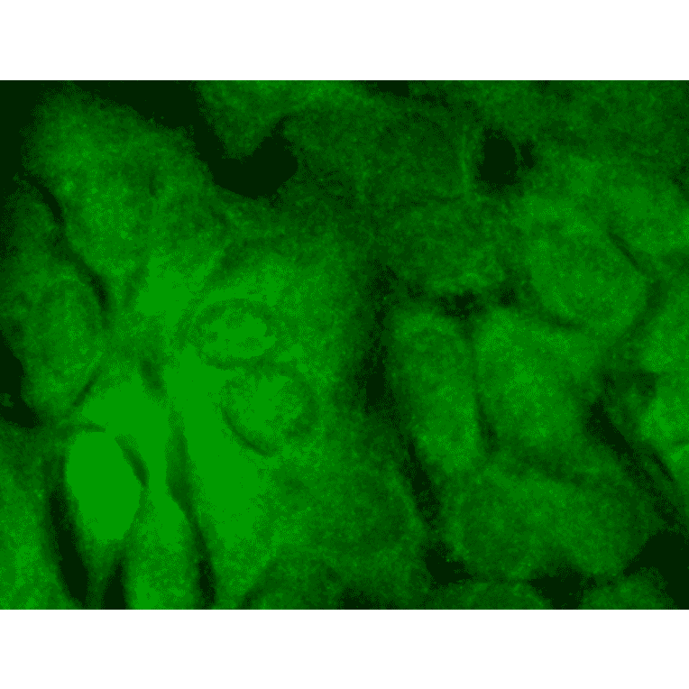 Immunocytochemistry/Immunofluorescence - Anti-SHANK3 Antibody [S69] (A304813) - Antibodies.com