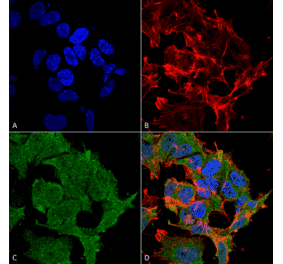 Immunocytochemistry/Immunofluorescence - Anti-SHANK2 Antibody [N23b/6] (A304814) - Antibodies.com