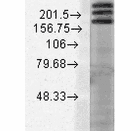 Western Blot - Anti-SHANK1 Antibody [N22/21] (A304815) - Antibodies.com