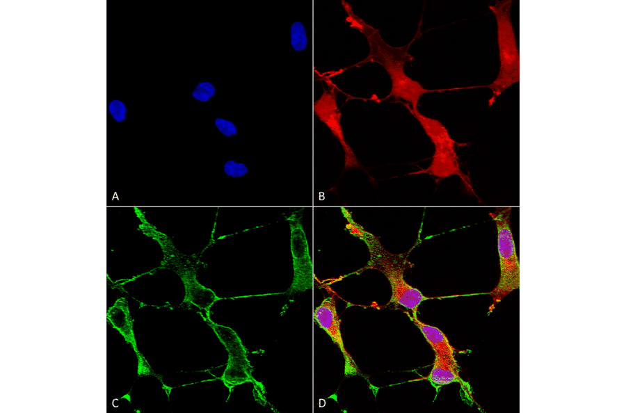 Immunocytochemistry/Immunofluorescence - Anti-SHANK1 Antibody [N22/21] (A304815) - Antibodies.com