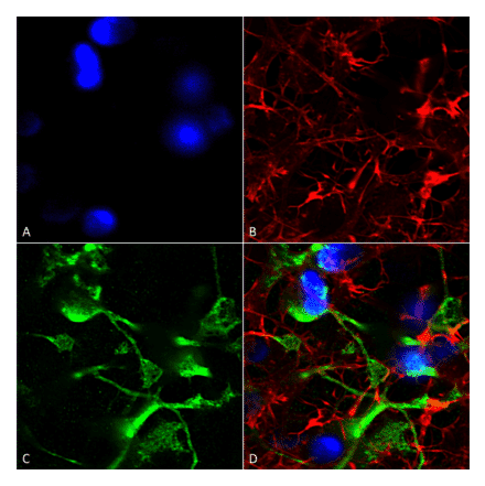 Immunocytochemistry/Immunofluorescence - Anti-ABCC9 Antibody [S319A-14] (A304816) - Antibodies.com