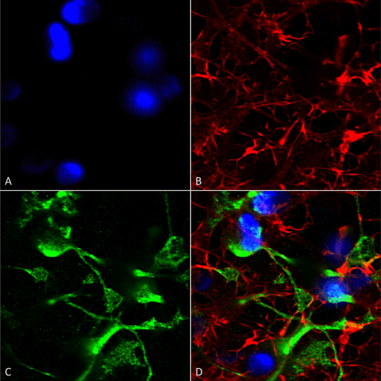 Immunocytochemistry/Immunofluorescence - Anti-ABCC9 Antibody [S319A-14] (A304816) - Antibodies.com