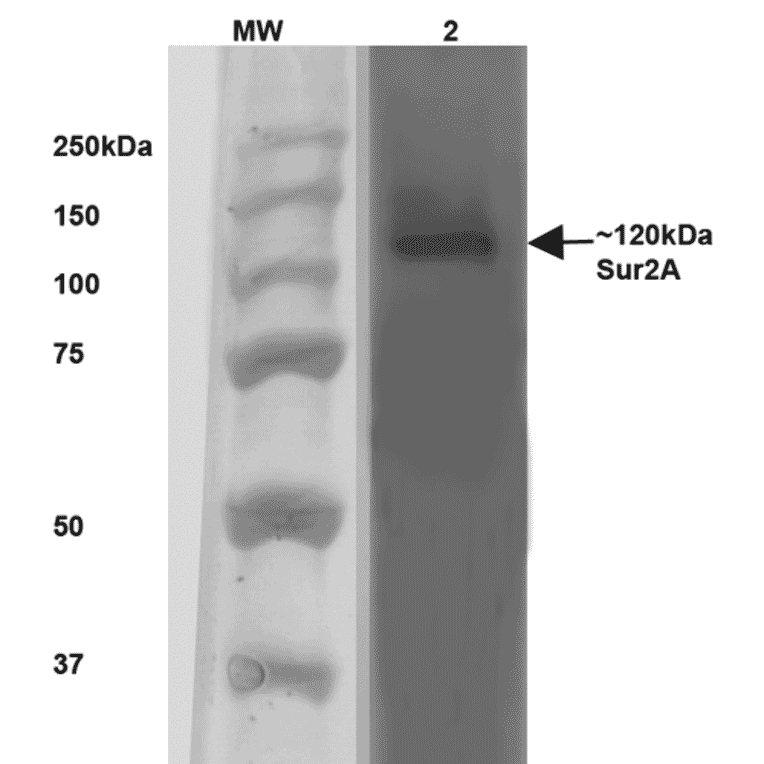 Western Blot - Anti-ABCC9 Antibody [S319A-14] (A304816) - Antibodies.com