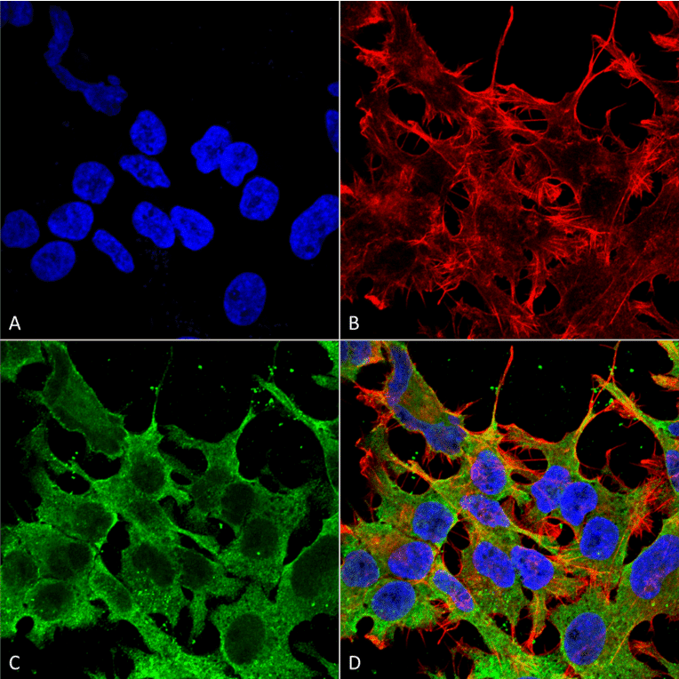 Immunocytochemistry/Immunofluorescence - Anti-ABCC9 Antibody [S319A-14] (A304816) - Antibodies.com