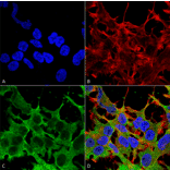 Immunocytochemistry/Immunofluorescence - Anti-ABCC9 Antibody [S319A-14] (A304816) - Antibodies.com