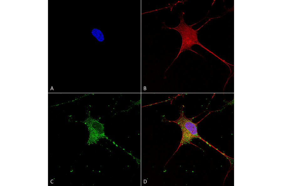 Immunocytochemistry/Immunofluorescence - Anti-SUR1 Antibody [S289-16] (A304817) - Antibodies.com