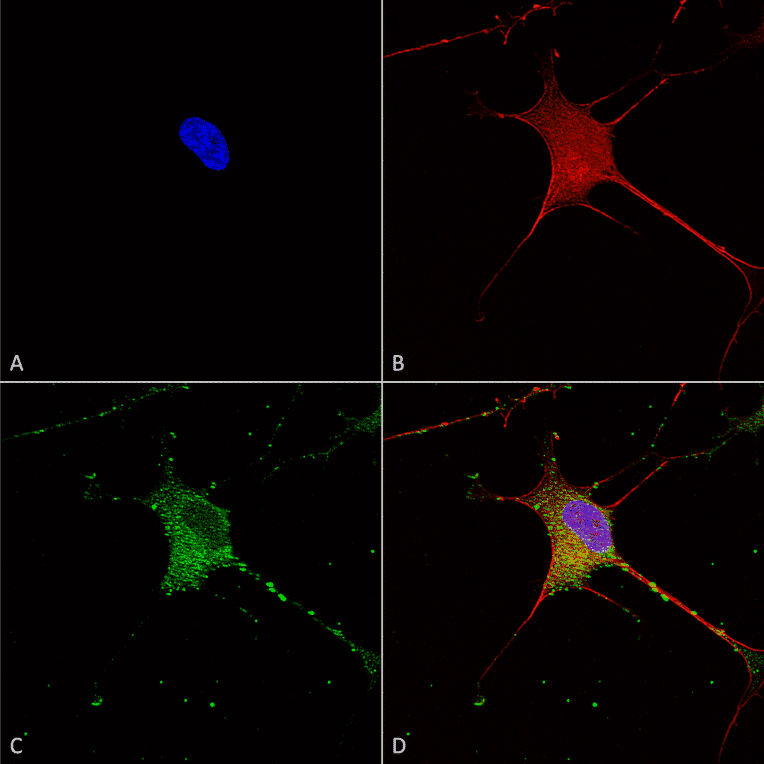 Immunocytochemistry/Immunofluorescence - Anti-SUR1 Antibody [S289-16] (A304817) - Antibodies.com