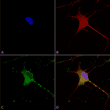 Immunocytochemistry/Immunofluorescence - Anti-SUR1 Antibody [S289-16] (A304817) - Antibodies.com