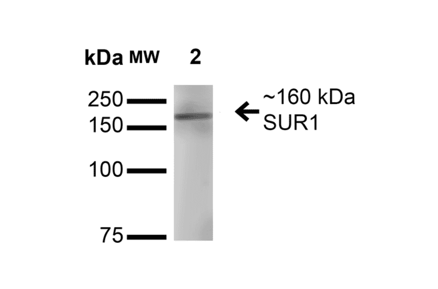 Western Blot - Anti-SUR1 Antibody [S289-16] (A304817) - Antibodies.com