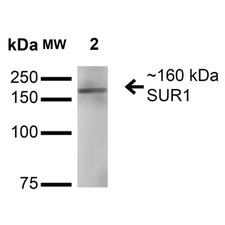 Western Blot - Anti-SUR1 Antibody [S289-16] (A304817) - Antibodies.com
