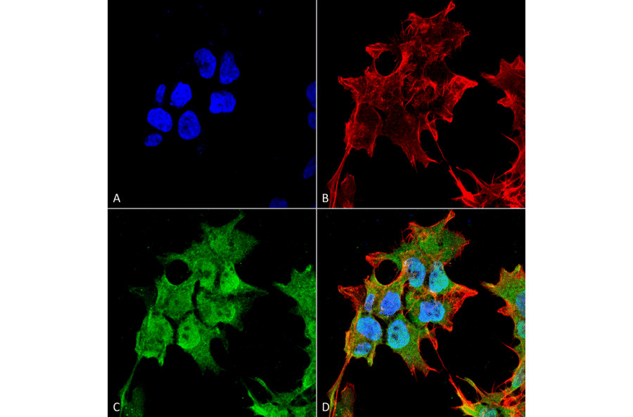 Immunocytochemistry/Immunofluorescence - Anti-SUR1 Antibody [S289-16] (A304817) - Antibodies.com