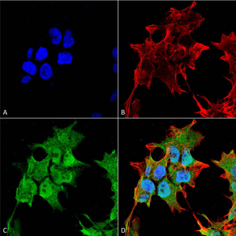 Immunocytochemistry/Immunofluorescence - Anti-SUR1 Antibody [S289-16] (A304817) - Antibodies.com