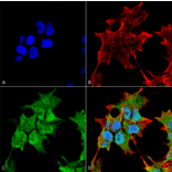 Immunocytochemistry/Immunofluorescence - Anti-SUR1 Antibody [S289-16] (A304817) - Antibodies.com