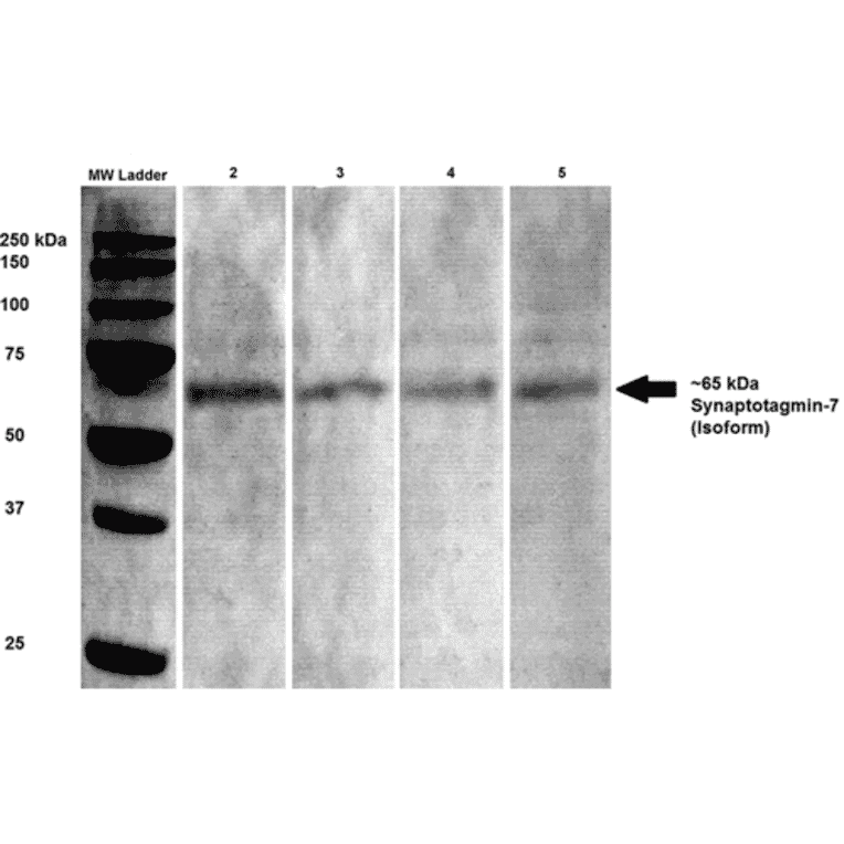 Western Blot - Anti-Synaptotagmin VII Antibody [S275-14] (A304818) - Antibodies.com