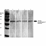 Western Blot - Anti-Synaptotagmin VII Antibody [S275-14] (A304818) - Antibodies.com
