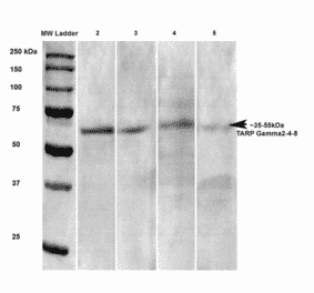 Western Blot - Anti-Stargazin Antibody [S245-36] (A304819) - Antibodies.com