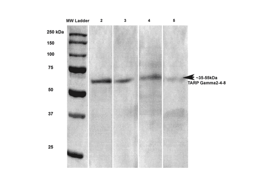 Western Blot - Anti-Stargazin Antibody [S245-36] (A304819) - Antibodies.com