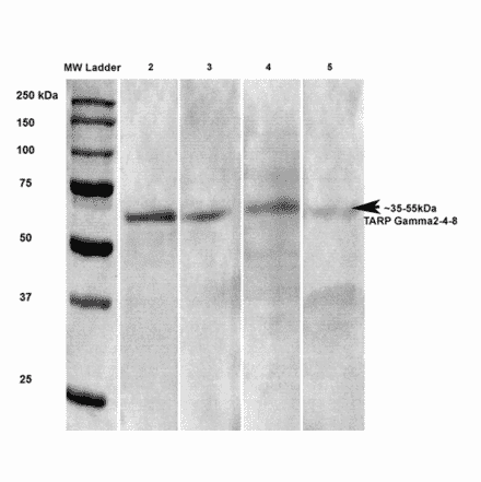Western Blot - Anti-Stargazin Antibody [S245-36] (A304819) - Antibodies.com
