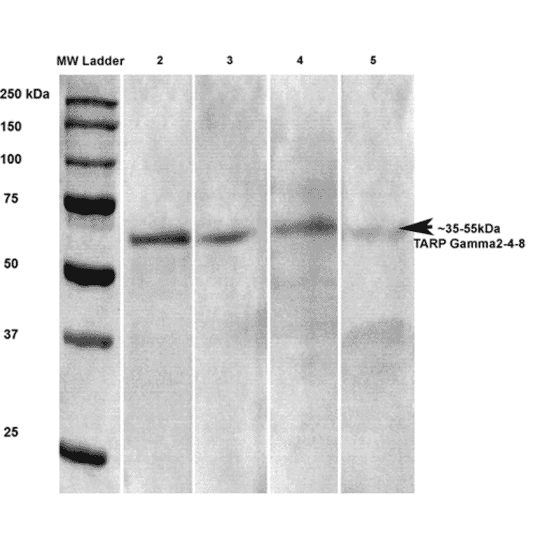 Western Blot - Anti-Stargazin Antibody [S245-36] (A304819) - Antibodies.com