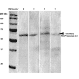 Western Blot - Anti-Stargazin Antibody [S245-36] (A304819) - Antibodies.com