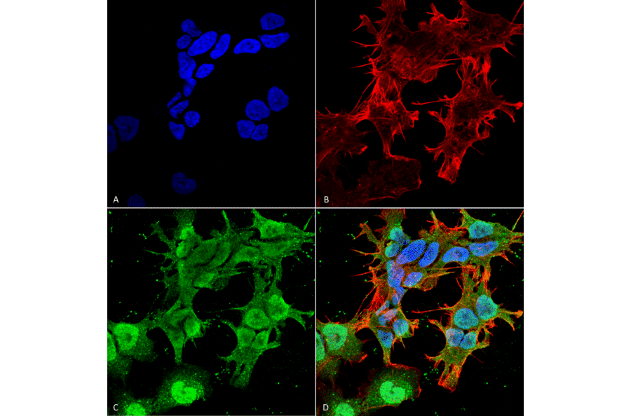 Immunocytochemistry/Immunofluorescence - Anti-Stargazin Antibody [S245-36] (A304819) - Antibodies.com