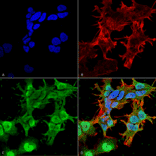Immunocytochemistry/Immunofluorescence - Anti-Stargazin Antibody [S245-36] (A304819) - Antibodies.com