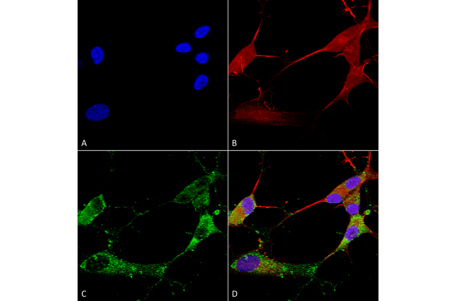 Immunocytochemistry/Immunofluorescence - Anti-Stargazin Antibody [S245-36] (A304819) - Antibodies.com