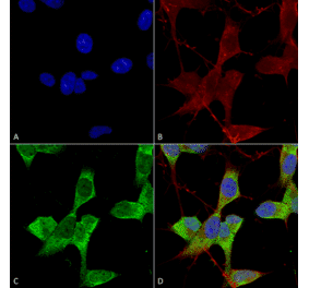 Immunocytochemistry/Immunofluorescence - Anti-KCNK3 Antibody [S374-48] (A304820) - Antibodies.com