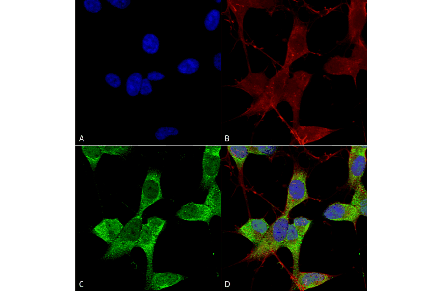 Immunocytochemistry/Immunofluorescence - Anti-KCNK3 Antibody [S374-48] (A304820) - Antibodies.com