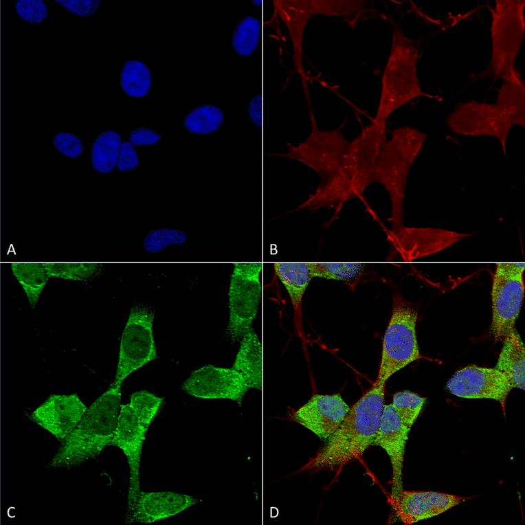 Immunocytochemistry/Immunofluorescence - Anti-KCNK3 Antibody [S374-48] (A304820) - Antibodies.com