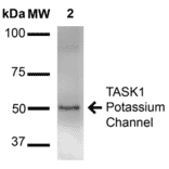 Western Blot - Anti-KCNK3 Antibody [S374-48] (A304820) - Antibodies.com