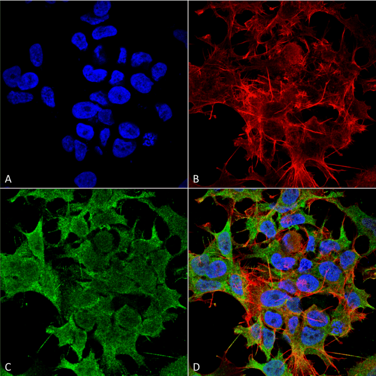 Immunocytochemistry/Immunofluorescence - Anti-KCNK3 Antibody [S374-48] (A304820) - Antibodies.com