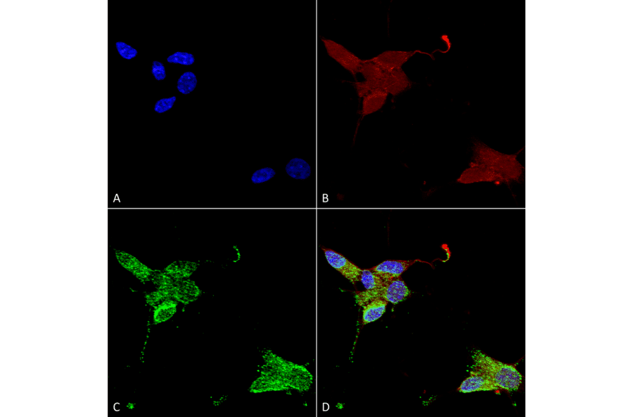 Immunocytochemistry/Immunofluorescence - Anti-TRPM7 Antibody [S74] (A304821) - Antibodies.com